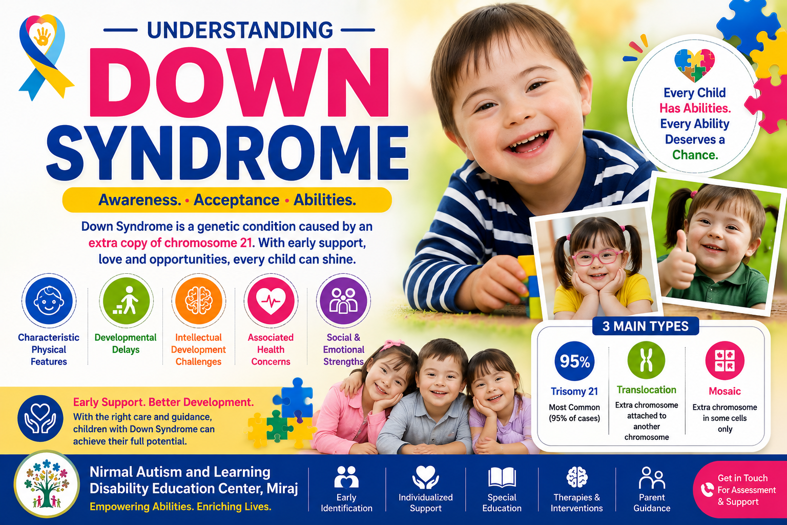 down syndrome